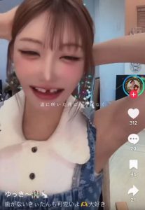 【動画】元トップAV女優の明日香キララさん(37)、美貌を得た代償に歯を失ってしまう
